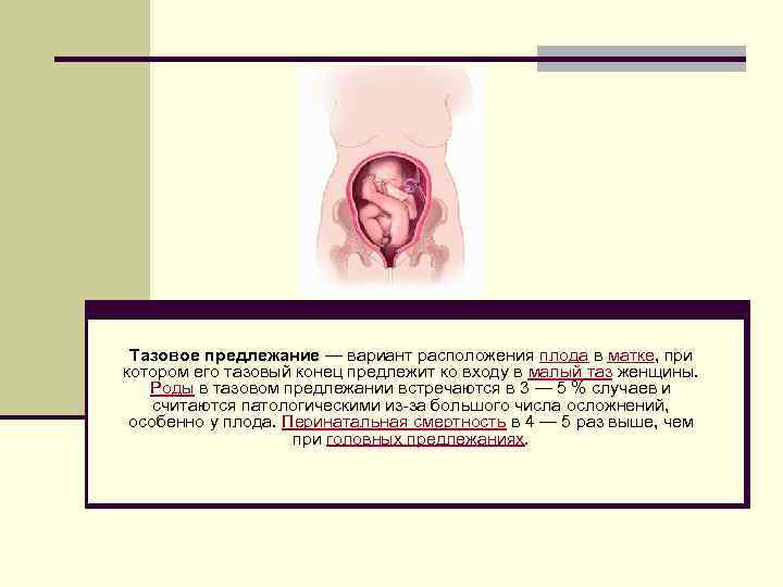 Тазовое предлежание — вариант расположения плода в матке, при котором его тазовый конец предлежит