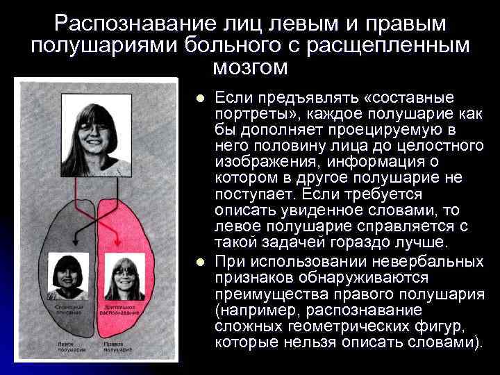 Распознавание лиц левым и правым полушариями больного с расщепленным мозгом l l Если предъявлять