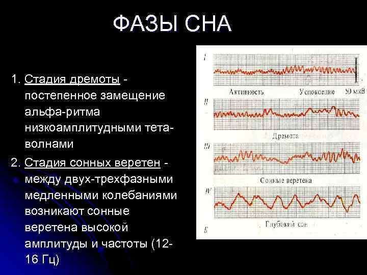 ФАЗЫ СНА 1. Стадия дремоты - постепенное замещение альфа-ритма низкоамплитудными тетаволнами 2. Стадия сонных
