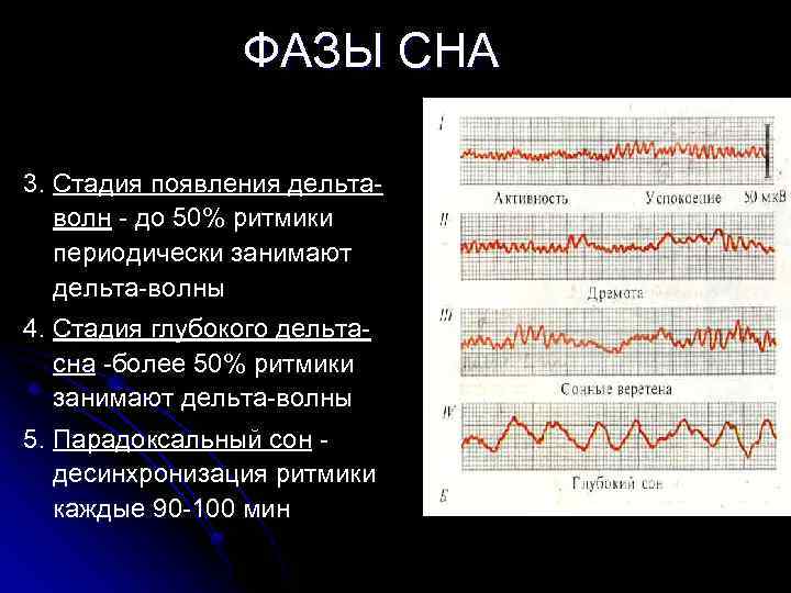 ФАЗЫ СНА 3. Стадия появления дельтаволн - до 50% ритмики периодически занимают дельта-волны 4.