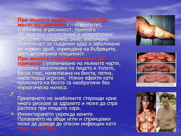  • При мъжете анаболните стероиди • • могат да причинят: стерилитет, увеличена агресивност,