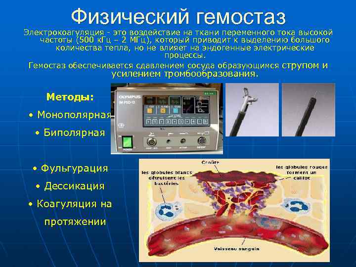 Физический гемостаз Электрокоагуляция - это воздействие на ткани переменного тока высокой частоты (500 к.