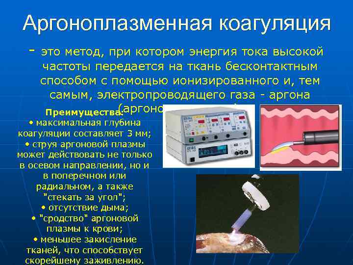 Аргоноплазменная коагуляция - это метод, при котором энергия тока высокой частоты передается на ткань