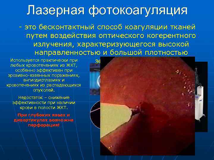 Лазерная фотокоагуляция - это бесконтактный способ коагуляции тканей путем воздействия оптического когерентного излучения, характеризующегося