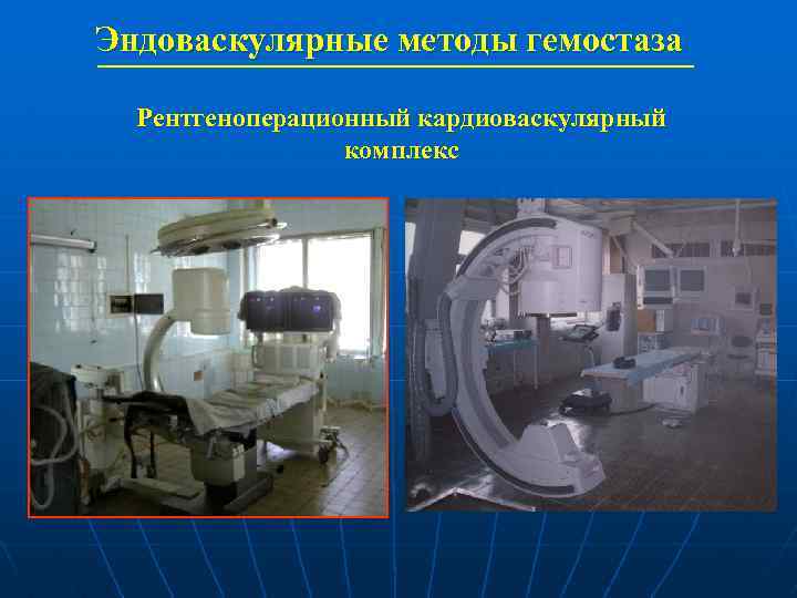 Эндоваскулярные методы гемостаза Рентгеноперационный кардиоваскулярный комплекс 