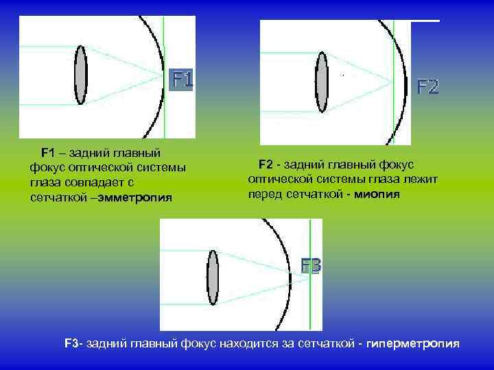 Оптический фокус картинки