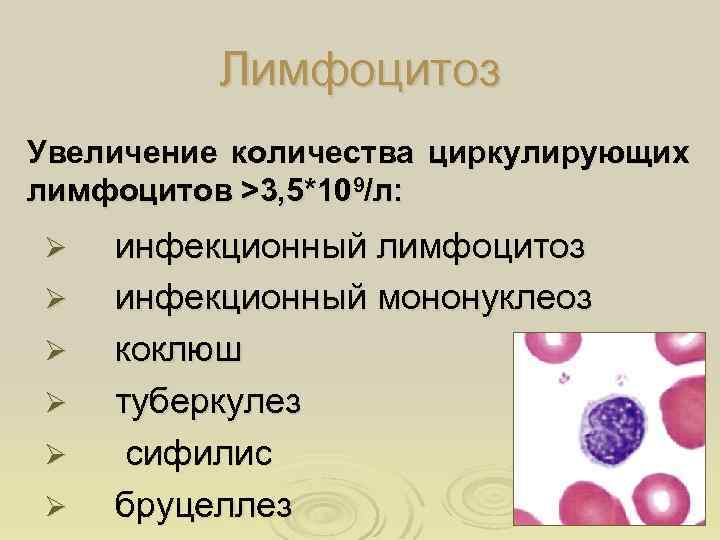 Лимфоцитоз Увеличение количества циркулирующих лимфоцитов >3, 5*109/л: Ø Ø Ø инфекционный лимфоцитоз инфекционный мононуклеоз