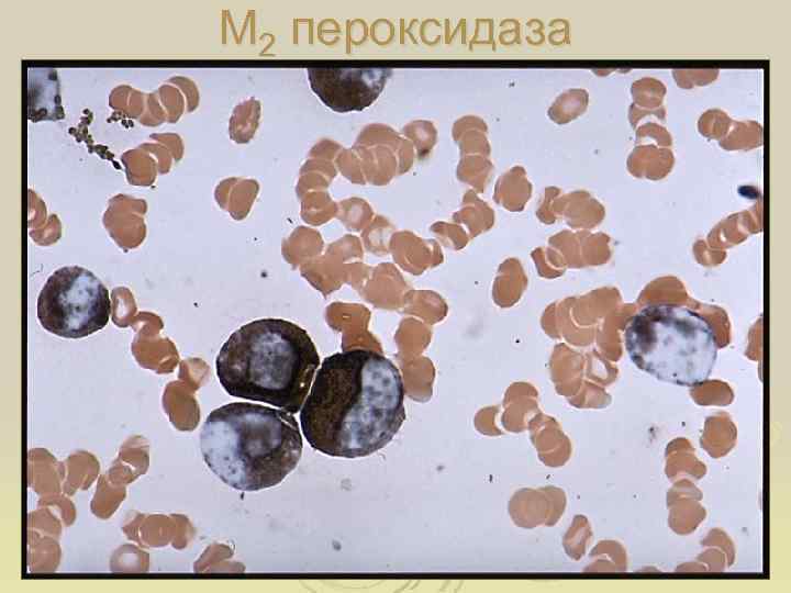 М 2 пероксидаза 