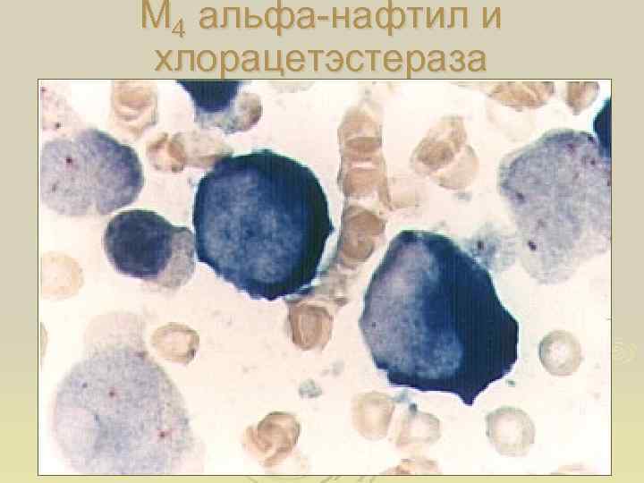 М 4 альфа-нафтил и хлорацетэстераза 