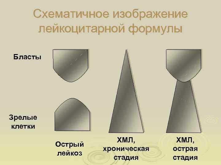 Схематичное изображение лейкоцитарной формулы Бласты Зрелые клетки Острый лейкоз ХМЛ, хроническая стадия ХМЛ, острая