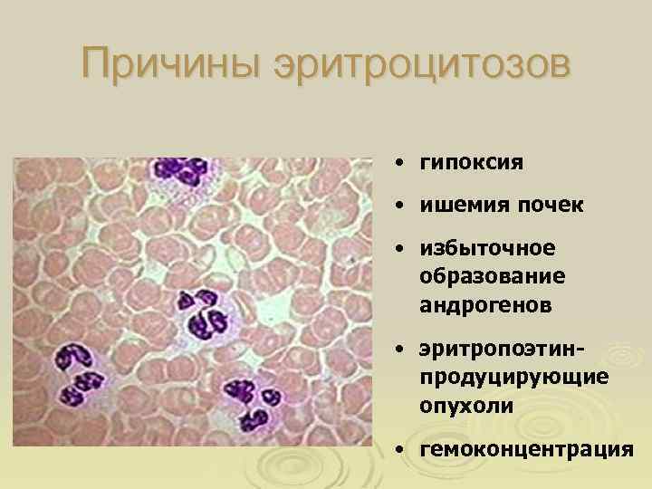 Причины эритроцитозов • гипоксия • ишемия почек • избыточное образование андрогенов • эритропоэтинпродуцирующие опухоли
