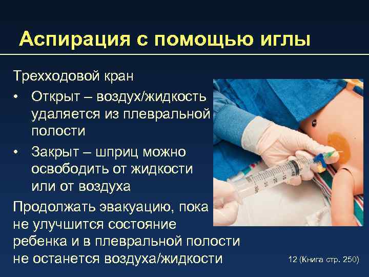 Аспирация с помощью иглы Трехходовой кран • Открыт – воздух/жидкость удаляется из плевральной полости