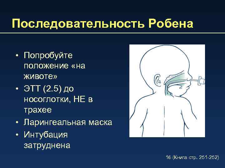 Последовательность Робена • Попробуйте положение «на животе» • ЭTT (2. 5) до носоглотки, НЕ