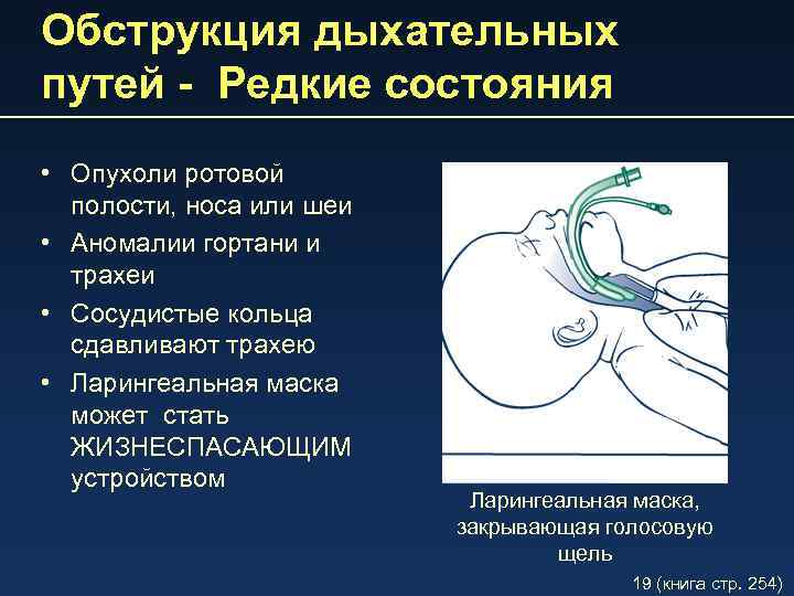 Обструкция дыхательных путей - Редкие состояния • Опухоли ротовой полости, носа или шеи •