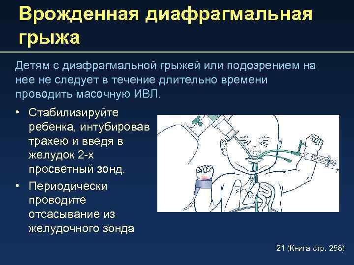 Врожденная диафрагмальная грыжа Детям с диафрагмальной грыжей или подозрением на нее не следует в