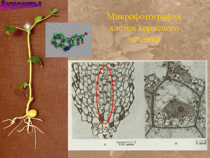 Микрофотография клеток корневого чехлика 
