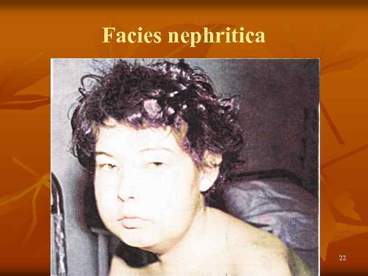 Facies nephritica 22 