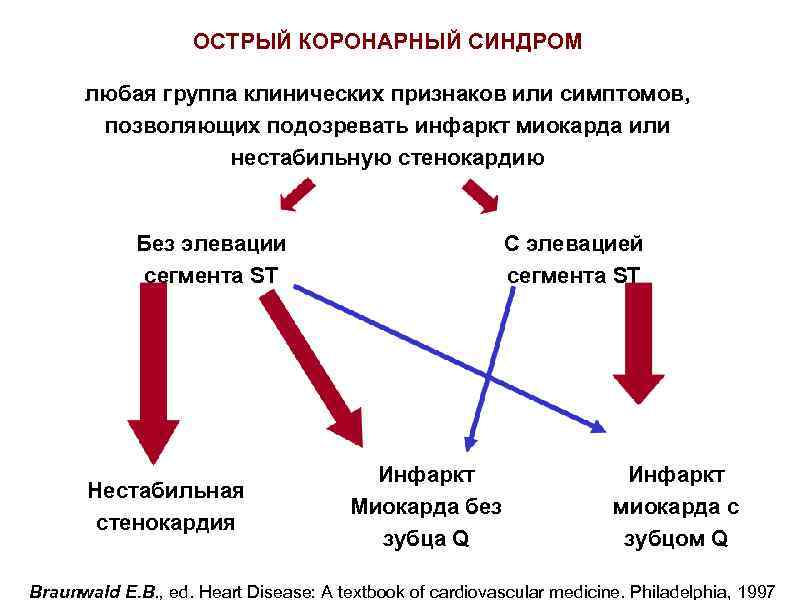 Острый коронарный синдром