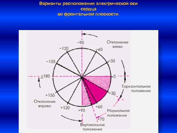 Варианты расположения электрической оси сердца во фронтальной плоскости. 