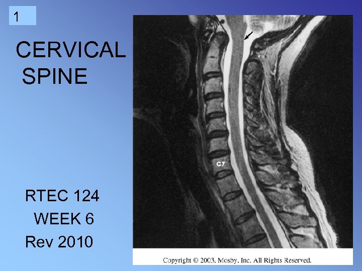 1 CERVICAL SPINE RTEC 124 WEEK 6 Rev 2010 