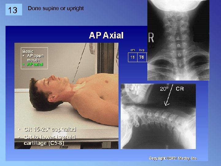 13 Done supine or upright 