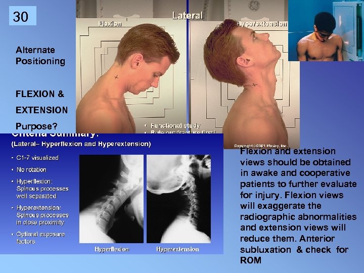 30 Alternate Positioning FLEXION & EXTENSION Purpose? Flexion and extension views should be obtained