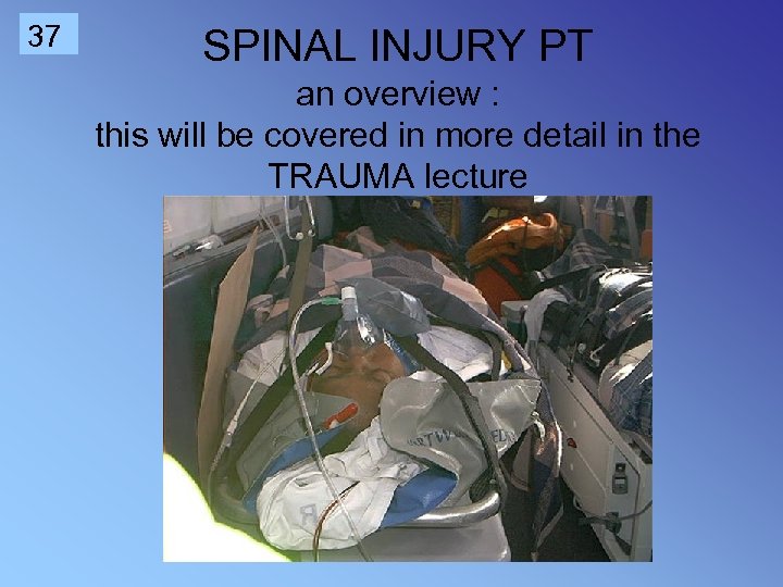 37 SPINAL INJURY PT an overview : this will be covered in more detail