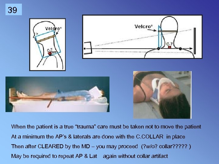 39 When the patient is a true “trauma” care must be taken not to