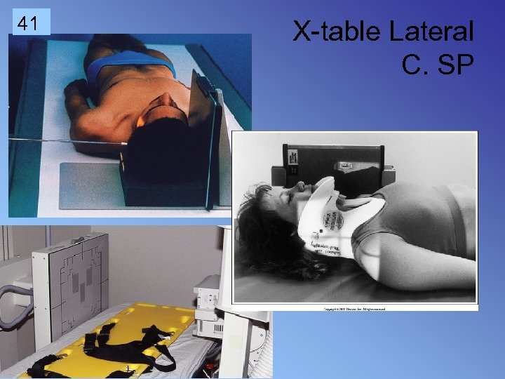 41 X-table Lateral C. SP 