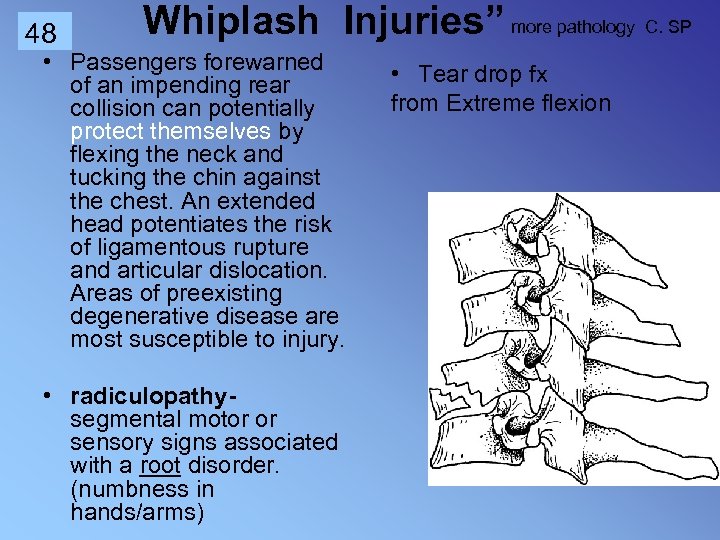 48 Whiplash Injuries” more pathology C. SP • Passengers forewarned of an impending rear