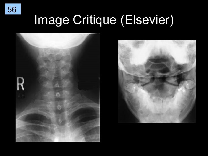 56 Image Critique (Elsevier) 