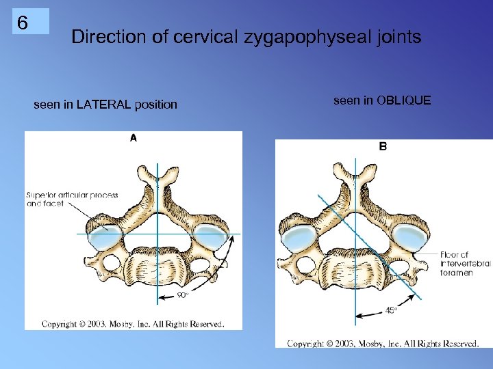 6 Direction of cervical zygapophyseal joints seen in LATERAL position seen in OBLIQUE 