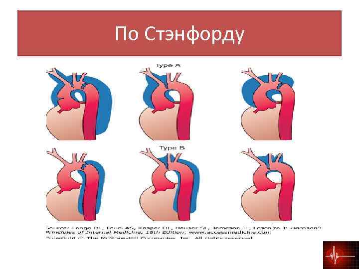По Стэнфорду 