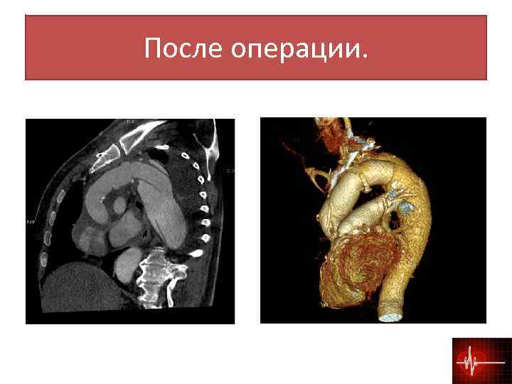 После операции. 