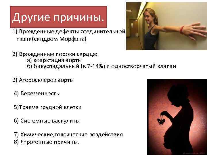 Другие причины. 1) Врожденные дефекты соединительной ткани(синдром Морфана) 2) Врожденные пороки сердца: а) коарктация