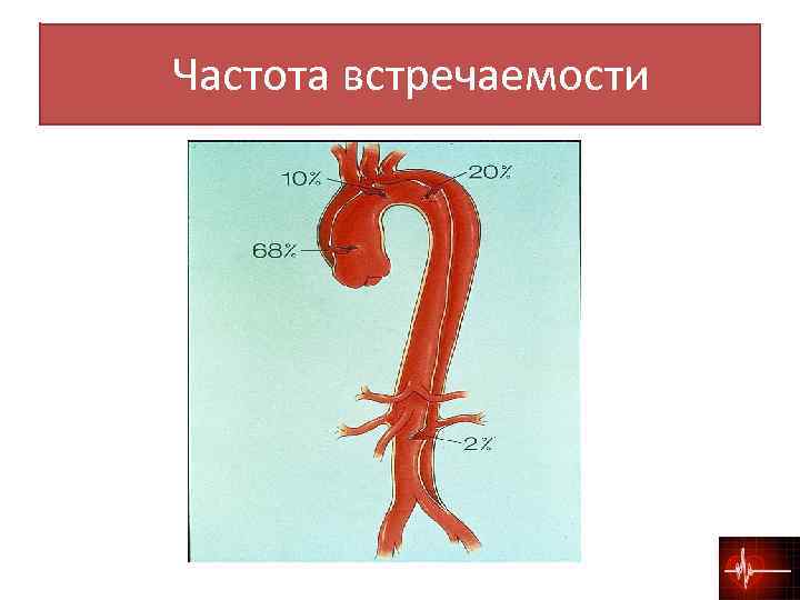  Частота встречаемости 