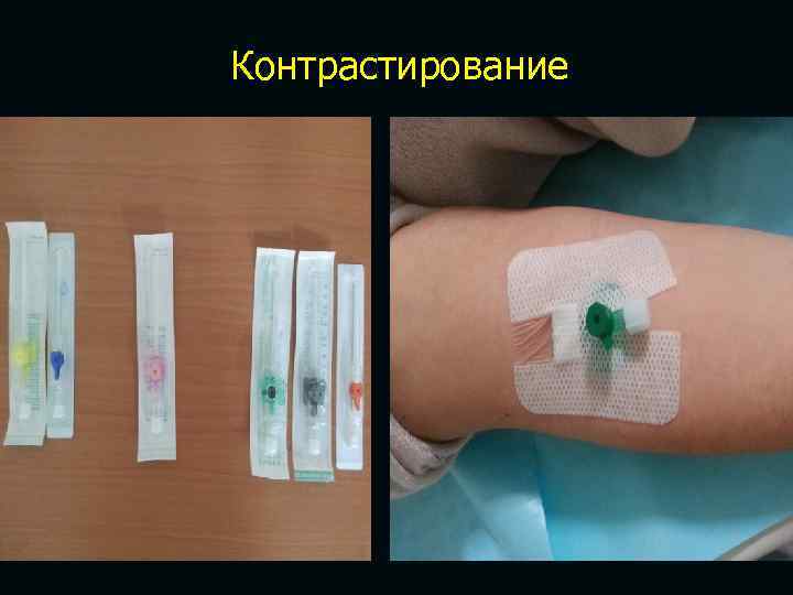 Контрастирование 