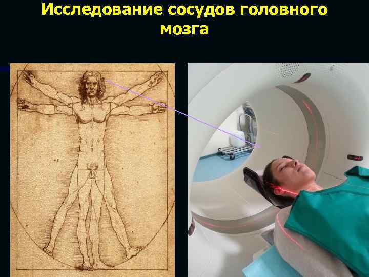 Исследование сосудов головного мозга 