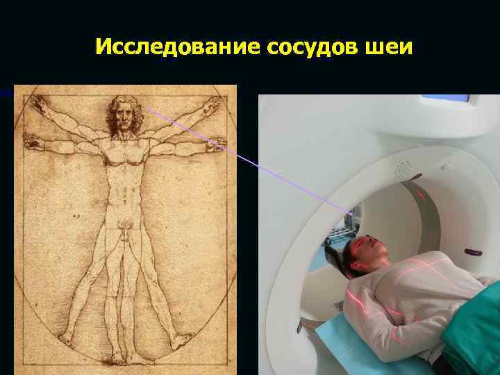 Исследование сосудов шеи 