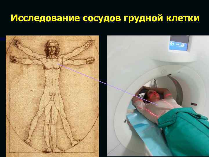 Исследование сосудов грудной клетки 