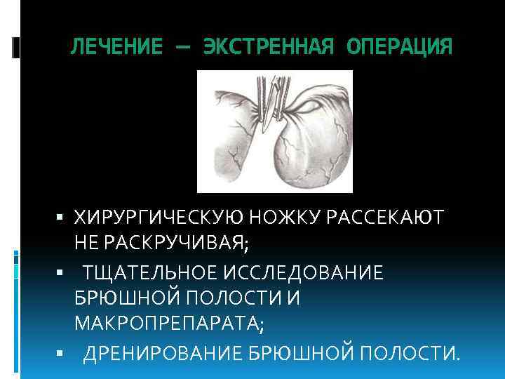 ЛЕЧЕНИЕ — ЭКСТРЕННАЯ ОПЕРАЦИЯ ХИРУРГИЧЕСКУЮ НОЖКУ РАССЕКАЮТ НЕ РАСКРУЧИВАЯ; ТЩАТЕЛЬНОЕ ИССЛЕДОВАНИЕ БРЮШНОЙ ПОЛОСТИ И
