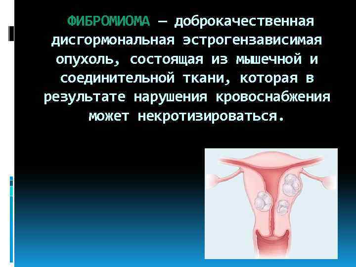  ФИБРОМИОМА — доброкачественная дисгормональная эстрогензависимая опухоль, состоящая из мышечной и соединительной ткани, которая