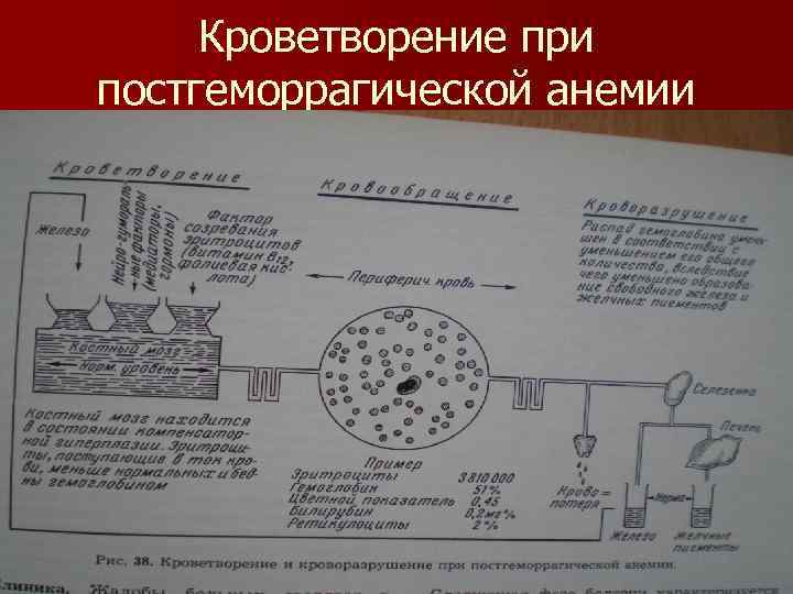 Кроветворение при постгеморрагической анемии 