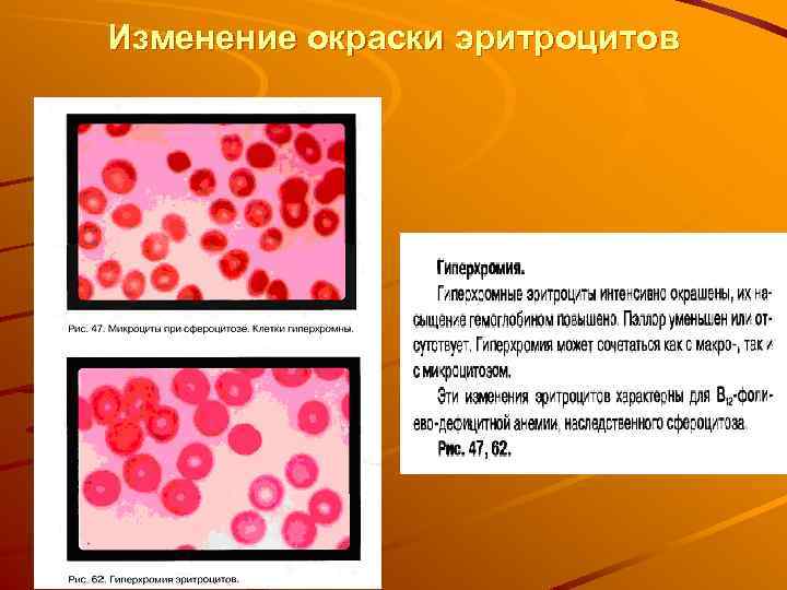 Изменение окраски эритроцитов 