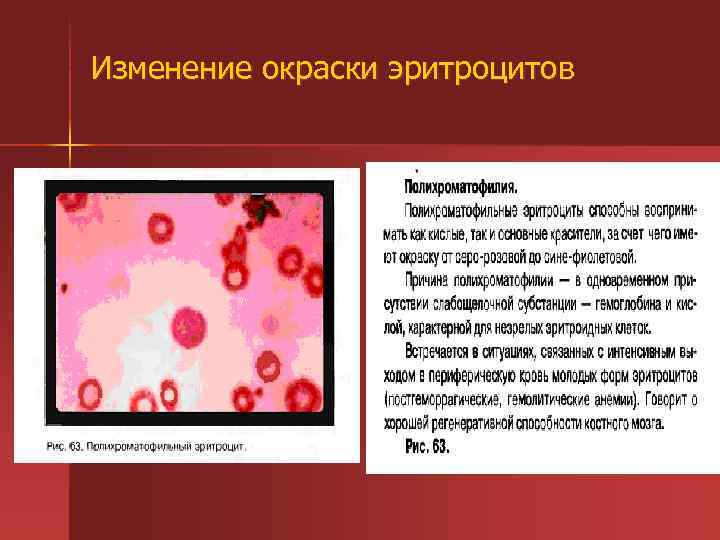 Изменение окраски эритроцитов 