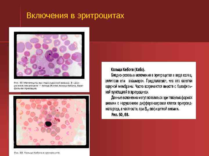 Включения в эритроцитах 