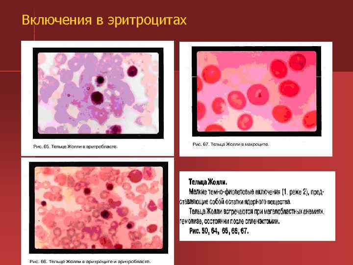 Включения в эритроцитах 