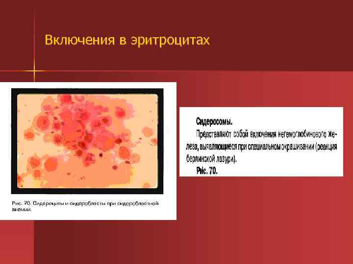 Включения в эритроцитах 