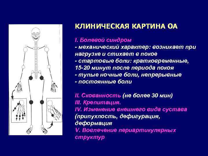 КЛИНИЧЕСКАЯ КАРТИНА ОА I. Болевой синдром - механический характер: возникает при нагрузке и стихает