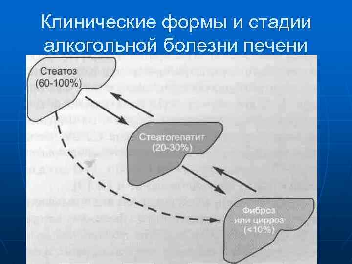 Клинические формы и стадии алкогольной болезни печени 